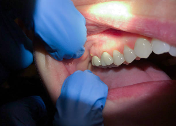 Best Same-Day Emergency Dentist in Omaha, TX