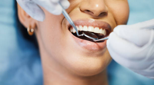 Best Emergency Dental Care for Trauma or Injury in Omaha, TX